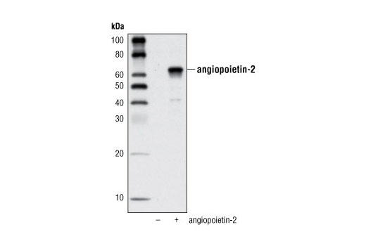 Western blot analysis of extracts from COS cells, untransfected or transfected with mouse angiopoietin-2, using Angiopoietin-2 Antibody.
