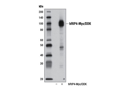 Western blot analysis of extracts from 293T cells, mock transfected (-) or transfected with a construct expressing Myc/DDK-tagged full-length human RIP4 isoform 2 (hRIP4-Myc/DDK; +), using RIP4 Antibody.