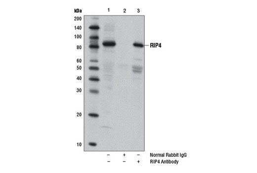 Immunoprecipitation of RIP4 from PANC-1 cell extracts, using Normal Rabbit IgG #2729 (lane 2) or RIP4 Antibody (lane 3). Lane 1 is 10% input. Western blot was performed using RIP4 Antibody. Mouse Anti-rabbit IgG (Conformation Specific) (L27A9) mAb #3678 was used as a secondary antibody to avoid detection of IgG.