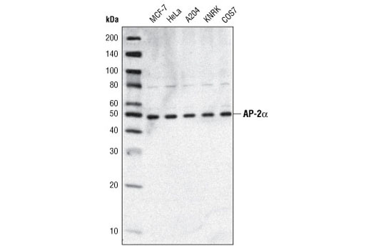 Western blot analysis of extracts from various cell types using AP-2α (C83E10) Rabbit mAb.