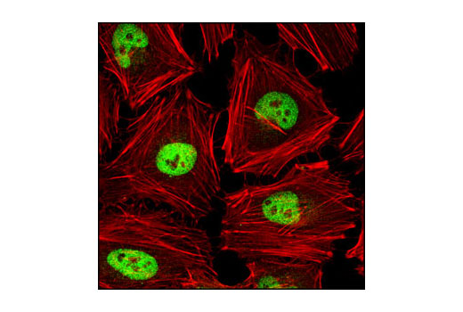 Confocal immunofluorescent analysis of HeLa cells using AP-2α (C83E10) Rabbit mAb (green). Actin filaments have been labeled with DY-554 phalloidin (red).