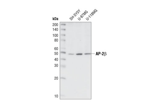 Western blot analysis of extracts from various cell lines, using AP-2β Antibody.