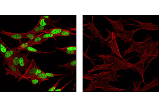 Confocal immunofluorescent analysis of SH-SY5Y cells labeled with AP-2β Antibody (green, left) compared to a nonspecific negative control antibody (right). Actin filaments have been labeled with Alexa Fluor® 555 phalloidin (red).