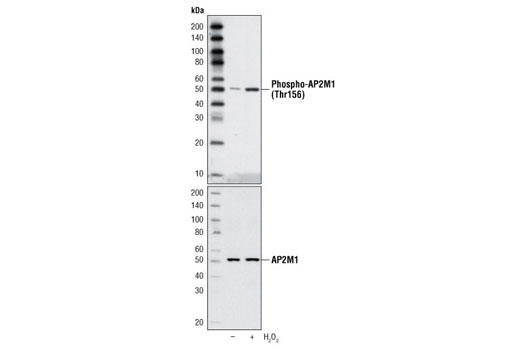 Western blot analysis of extracts from HeLa cells, serum-starved overnight and either untreated or H 2 O 2 -treated (4 mM, 30 minutes), using Phospho-AP2M1 (Thr156) Antibody (upper) or an AP2M1 rabbit mAb (lower).