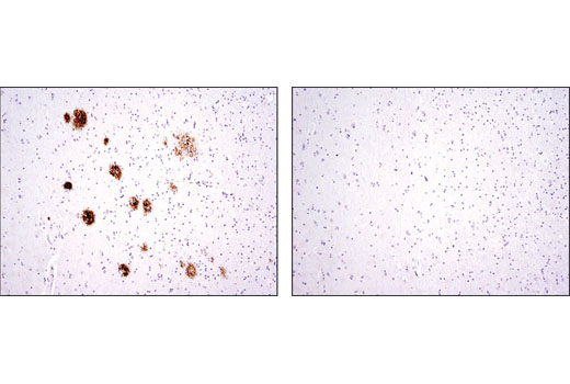 Immunohistochemical analysis of paraffin-embedded human Alzheimer's brain using β-Amyloid (D12B2) Rabbit mAb in the presence of control peptide (left) or antigen-specific peptide (right).