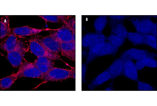 Confocal microscopic images of SH-SY5Y cells showing cytoplasmic and ER stain with APP Antibody (A, red) compared to an isotype control (B). Blue pseudocolor = DRAQ5ä (fluorescent DNA dye).
