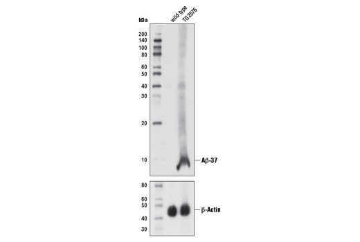 Western blot analysis of brain extracts from 13-month old wild-type and TG2576 mice using β-Amyloid (1-37 Specific) (D2A6H) Rabbit mAb (upper) or β-Actin (D6A8) Rabbit mAb #8457 (lower).
