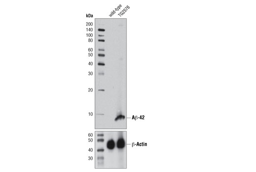 Western blot analysis of brain extracts from 13-month old wild-type and TG2576 mice using β-Amyloid (1-42 Specific) (D3E10) Rabbit mAb (upper) or β-Actin (D6A8) Rabbit mAb #8457 (lower).
