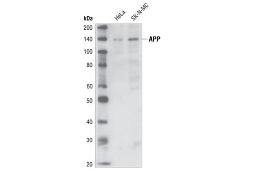 Western blot analysis of extracts from HeLa and SK-N-MC cells, using APP/beta-Amyloid (NAB228) Mouse mAb.