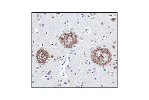 Immunohistochemical analysis of paraffin-embedded Alzheimer's brain, using APP/beta-Amyloid (NAB228) Mouse mAb.