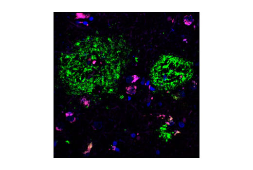 Confocal immunofluorescent analysis of paraffin-embedded human Alzheimer's brain using APP/β-Amyloid (NAB228) Mouse mAb (green) and Phospho-p44/42 MAPK (Thr202/Tyr204) (197G2) Rabbit mAb #4377 (red). Blue pseudocolor = DRAQ5™ (fluorescent DNA dye).