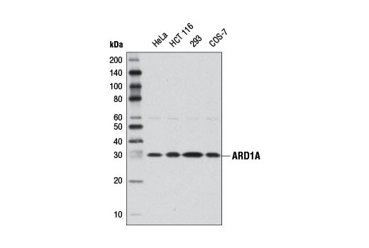 Western blot analysis of extracts from various cell lines using ARD1A Antibody.