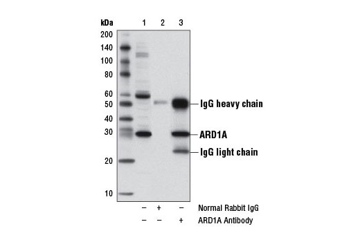 Immunoprecipitation of ARD1A from HeLa cell extracts, using Normal Rabbit IgG #2729 (lane 2) or ARD1A Antibody (lane 3). Lane 1 is 10% input. Western blot analysis was performed using ARD1A Antibody.