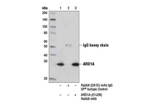 Immunoprecipitation of ARD1A from 293 cell extracts using Rabbit (DA1E) mAb IgG XP ® Isotype Control #3900 (lane 2) or ARD1A (E1J2B) Rabbit mAb (lane 3). Lane 1 is 10% input. Western blot analysis was performed using ARD1A (E1J2B) Rabbit mAb.