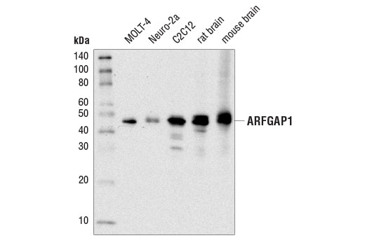 Western blot analysis of extracts from various cell lines and tissues using ARFGAP1 (D4C2M) Rabbit mAb.