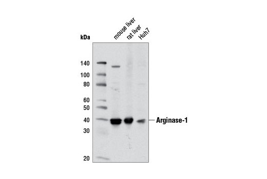Western blot analysis of extracts from mouse liver, rat liver, and Huh7 cells using Arginase-1 Antibody.