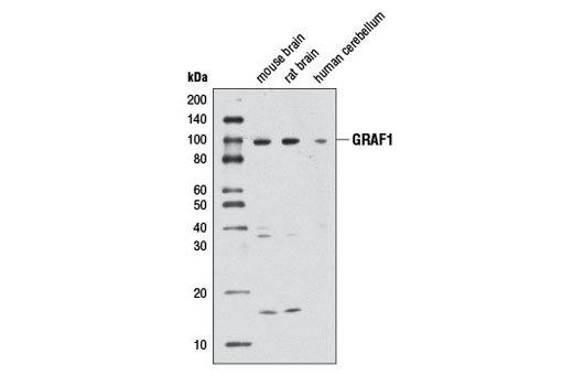 Western blot analysis of extracts from mouse brain, rat brain, and human cerebellum using GRAF1 Antibody.