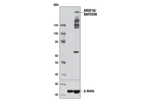 Western blot analysis of T-47D and Jurkat cell extracts using ARID1A/BAF250A (D2A8U) Rabbit mAb (upper) or ß-Actin (D6A8) Rabbit mAb #8457 (lower). Additional ARID1A/BAF250A degradation products may be detected in some cell extracts between 135kDa-250kDa, which are absent in the ARID1A/BAF250A negative T-47D cell line.