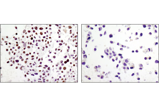 Immunohistochemical analysis of paraffin-embedded cell pellets, COS-7 (left) or T-47D (right), using ARID1A/BAF250A (D2A8U) Rabbit mAb.