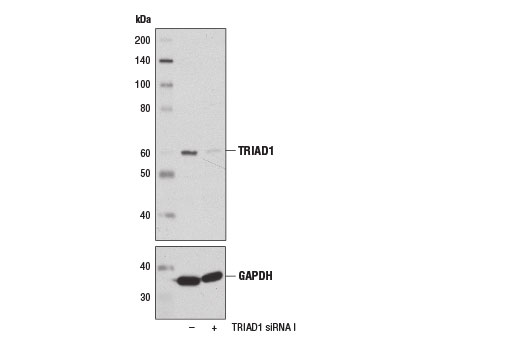 Western blot analysis of extracts from 293T cells, transfected with 100 nM SignalSilence ® Control siRNA (Unconjugated) #6568 (-) or SignalSilence ® TRIAD1 siRNA Ι #13719 (+), using TRIAD1 Antibody (upper) and GAPDH (D16H11) XP ® Rabbit mAb #5174 (lower). The TRIAD Antibody confirms silencing of TRIAD1 expression, while the GAPDH (D16H11) XP ® Rabbit mAb is used as a loading control.
