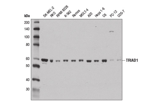 Western blot analysis of extracts from various cell lines using TRIAD1 Antibody.