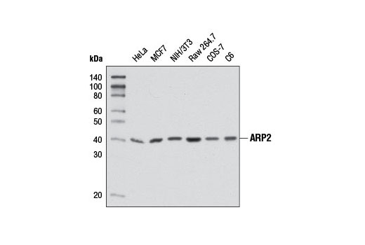 Western blot analysis of extracts from various cell lines using ARP2 (D85D5) Rabbit mAb.
