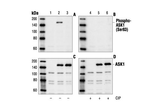 Western blot analysis of extracts from NIH/3T3 cells, untransfected (lanes 1 and 4) or transfected wild type (lanes 2 and 5) or Ser83Ala mutant (lanes 3 and 6) ASK1, using Phospho-ASK1 (Ser83) Antibody (A and B) or ASK1 Antibody #3762 (C and D). The phospho-specificity of the antibody was further characterized by treating the membranes (B and D) with calf intestinal alkaline phosphatase (CIP) after Western transfer.