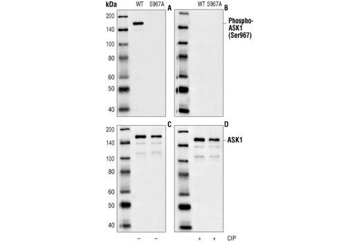 Western blot analysis of extracts from COS7 cells transfected with wild-type or Ser967Ala mutant ASK1, using Phospho-ASK1 (Ser967) Antibody (A,B) or ASK1 Antibody #3762 (C,D). The phospho-specificity of the antibody was further characterized by treating the membrane with calf intestinal alkaline phosphatase (CIP) after Western transfer (B,D).