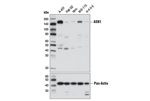 Western blot analysis of extracts from various cell lines using ASK1 (D11C9) Rabbit mAb (upper) or Pan-Actin (D18C11) Rabbit mAb #8456 (lower).