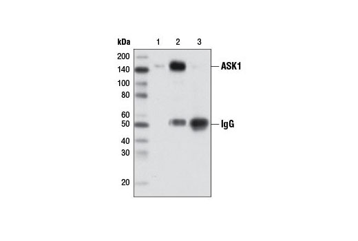 Immunoprecipitation of ASK1 from A-431 cell extracts using ASK1 (D11C9) Rabbit mAb (lane 2) or Normal Rabbit IgG #2729 (lane 3). Lane 1 is 10% input.
