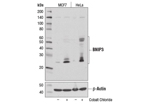  Western blot analysis of MCF7 and HeLa cells, untreated (-) or cobalt chloride-treated (100 μM, overnight; +), using BNIP3 Antibody (upper) and β-Actin (D6A8) Rabbit mAb #8457 (lower).