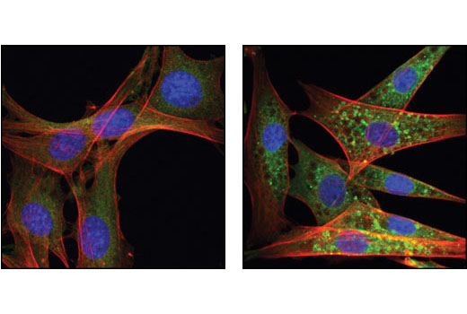 Confocal immunofluorescent analysis of NIH/3T3 cells, untreated (left) or chloroquine-treated (right), using Atg12 Antibody (Mouse Specific) (green). Actin filaments have been labeled with Alexa Fluor ® 555 phalloidin (red). Blue pseudocolor = DRAQ5 ® #4084 (fluorescent DNA dye).