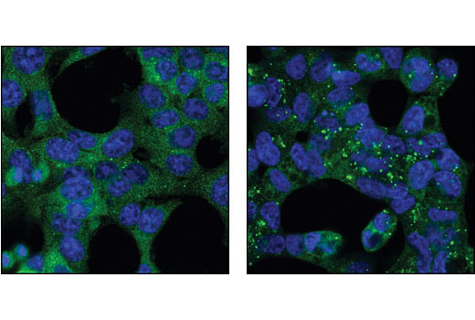 Confocal immunofluorescent analysis of HCT-116 cells, untreated (left) or chloroquine-treated (right), using Atg12 Antibody (Human Specific) (green). Blue pseudocolor = DRAQ5 ® #4084 (fluorescent DNA dye).