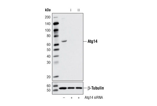 Western blot analysis of extracts from HeLa cells, transfected with 100 nM SignalSilence ® Control siRNA (Unconjugated) #6568 (-), SignalSilence ® Atg14 siRNA I #6286 (+) or SignalSilence ® Atg14 siRNA II #6287 (+), using Atg14 Antibody #5504 (upper) or β-Tubulin (9F3) Rabbit mAb #2128 (lower). The Atg14 Antibody confirms silencing of Atg14 expression, while the β-Tubulin (9F3) Rabbit mAb is used as a loading control.