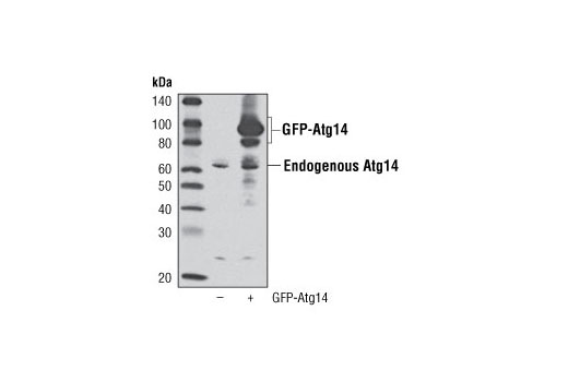 Western blot analysis of extracts from 293T cells, mock transfected (-) or transfected with a GFP-Atg14 construct (+), using Atg14 Antibody. GFP-Atg14 construct was kindly provided by Dr. Qing Zhong, University of California, Berkeley CA.