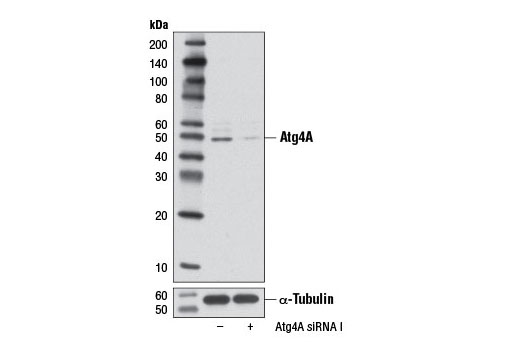Western blot analysis of extracts from HeLa cells, transfected with 100 nM SignalSilence ® Control siRNA (Unconjugated) #6568 (-) or SignalSilence ® Atg4A siRNA I #6427 (+), using Atg4A (D62C10) Rabbit mAb (upper) or α-Tubulin (11H10) Rabbit mAb #2125 (lower). The Atg4A (D62C10) Rabbit mAb confirms silencing of Atg4A expression, while the α-Tubulin (11H10) Rabbit mAb is used as a loading control.