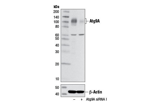 Western blot analysis of extracts from RD cells, transfected with 100 nM SignalSilence ® Control siRNA (Unconjugated) #6568 (-) or SignalSilence ® Atg9A siRNA I #7051 (+), using Atg9A (D4O9D) Rabbit mAb (upper) or β-Actin (D6A8) Rabbit mAb #8457 (lower). The Atg9A (D4O9D) Rabbit mAb confirms silencing of Atg9A expression while the β-Actin (D6A8) Rabbit mAb is used as a loading control.