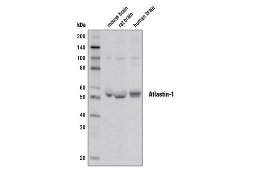 Western blot analysis of extracts from human, mouse and rat brain using Atlastin-1 (D2E6) Rabbit mAb.