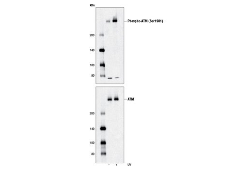 Western blot analysis of extracts from 293 cells, untreated or UV-treated (100 mJ, 4 hr recovery), using Phospho-ATM (Ser1981) (D6H9) Rabbit mAb (upper) or ATM (D2E2) Rabbit mAb #2873 (lower).