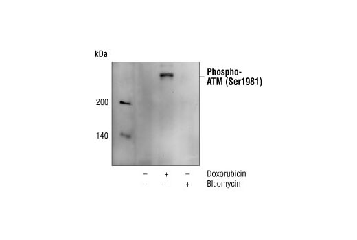 Western blot analysis of extracts from M059J cells, untreated, treated with doxorubicin, or treated with bleomycin, using Phospho-ATM (Ser1981) (10H11.E12) Mouse mAb.