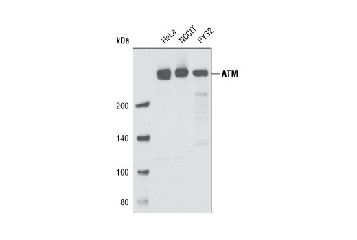 Western blot analysis of extracts of HeLa, NCCIT and PYS2 cells using ATM (D2E2) Rabbit mAb.