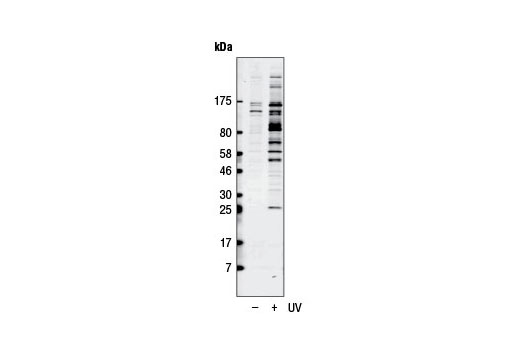 Western blot analysis of extracts from HeLa cells, untreated (-) or UV-treated (+, 50 mJ/cm 2 , 2 hr), using