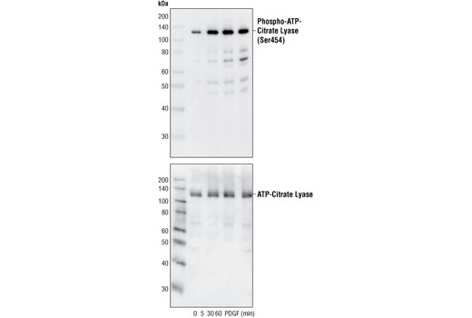 Western blot analysis of extracts from NIH/3T3 cells, untreated or PDGF-treated for the indicated times, using Phospho-ATP-Citrate Lyase (Ser455) Antibody (upper) or ATP-Citrate Lyase Antibody #4332 (lower).