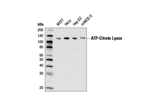 Western blot analysis of extracts from various cell lines using ATP-Citrate Lyase (D1X6P) Rabbit mAb.