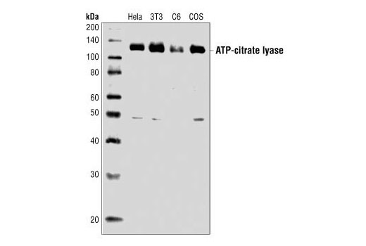 Western blot analysis of extracts from HeLa, NIH/3T3, C6 and COS cells, using ATP-Citrate Lyase Antibody.