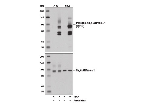 Western blot analysis of extracts from A-431 cells, untreated (-) or treated with Human Epidermal Growth Factor (hEGF) #8916 (100 ng/ml, 2 min; +), and HeLa cells, untreated (-) or pervanadate-treated (1 mM, 15 min; +), using Phospho-Na,K-ATPase α1 (Tyr10) (E1Y9C) Rabbit mAb (upper) and Na,K-ATPase Antibody #3010 (lower).
