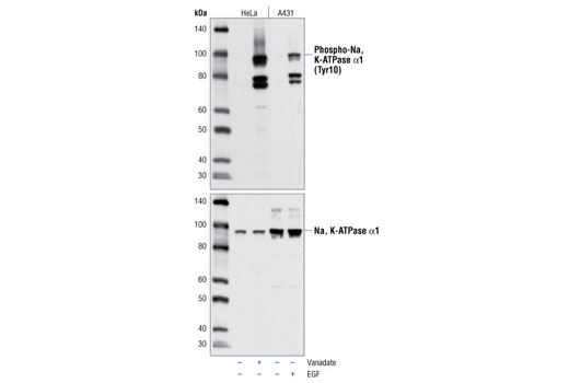 Western blot analysis of extracts from HeLa cells, untreated or vanadate-treated, and A431 cells, untreated or EGF-treated, using Phospho-Na,K-ATPase α1 (Tyr10) Antibody (upper) or total Na,K-ATPase α1 Antibody #3010 (lower).
