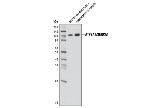 Western blot analysis of extracts from human skeletal muscle and mouse skeletal muscle using ATP2A1/SERCA1 (D54G12) Rabbit mAb.