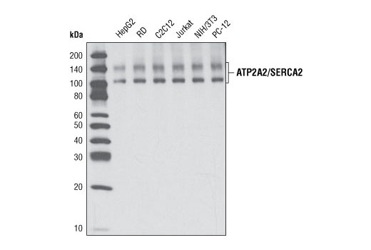 Western blot analysis of extracts from various cell types using ATP2A2/SERCA2 Antibody.