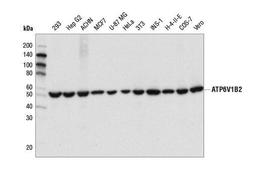 Western blot analysis of extracts from various cell lines using ATP6V1B2 (D2F9R) Rabbit mAb.